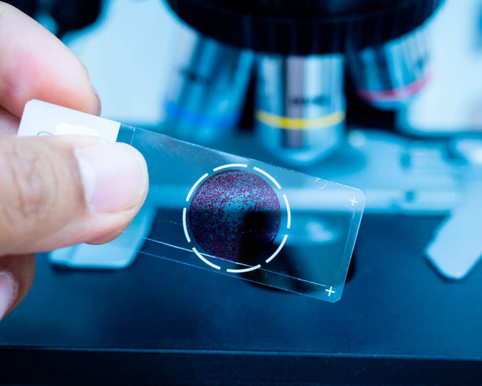 Portaobjetos con muestra sanguínea frente a un microscopio, cursos online