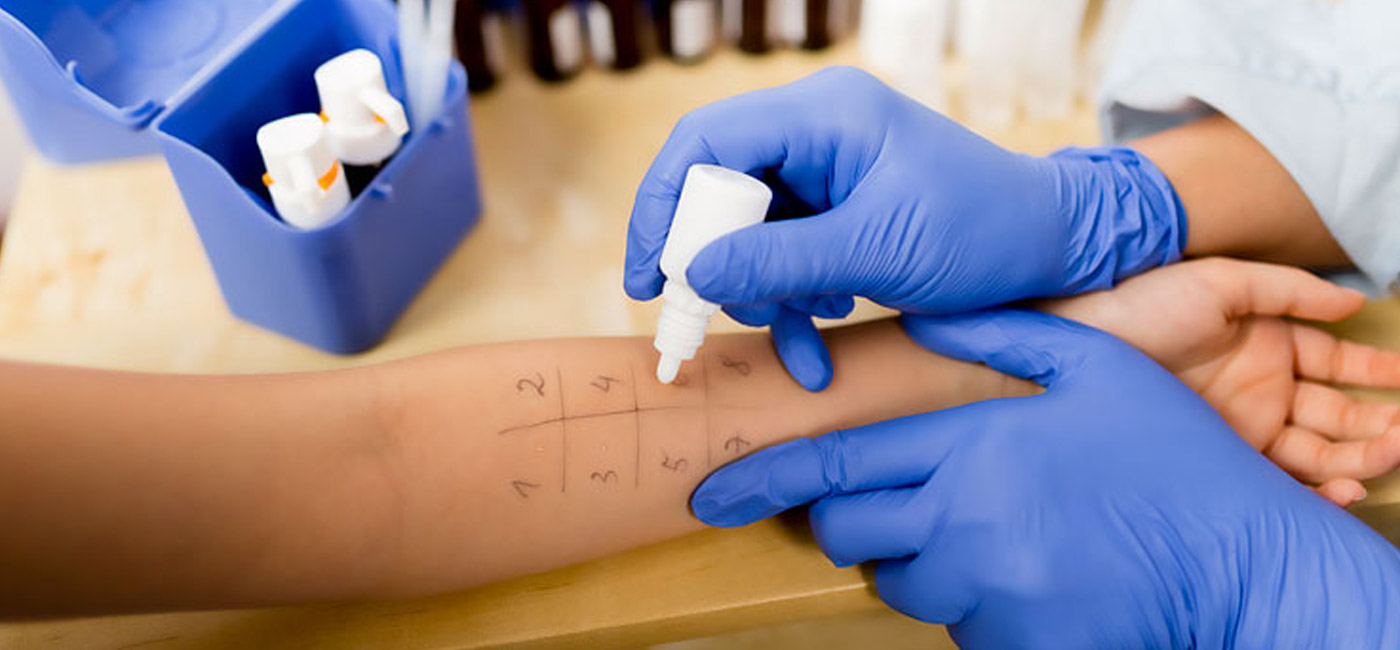 Prueba cutánea de alergia en antebrazo con cuadrícula numerada, profesional con guantes azules aplica gotas, cursos gratuitos
