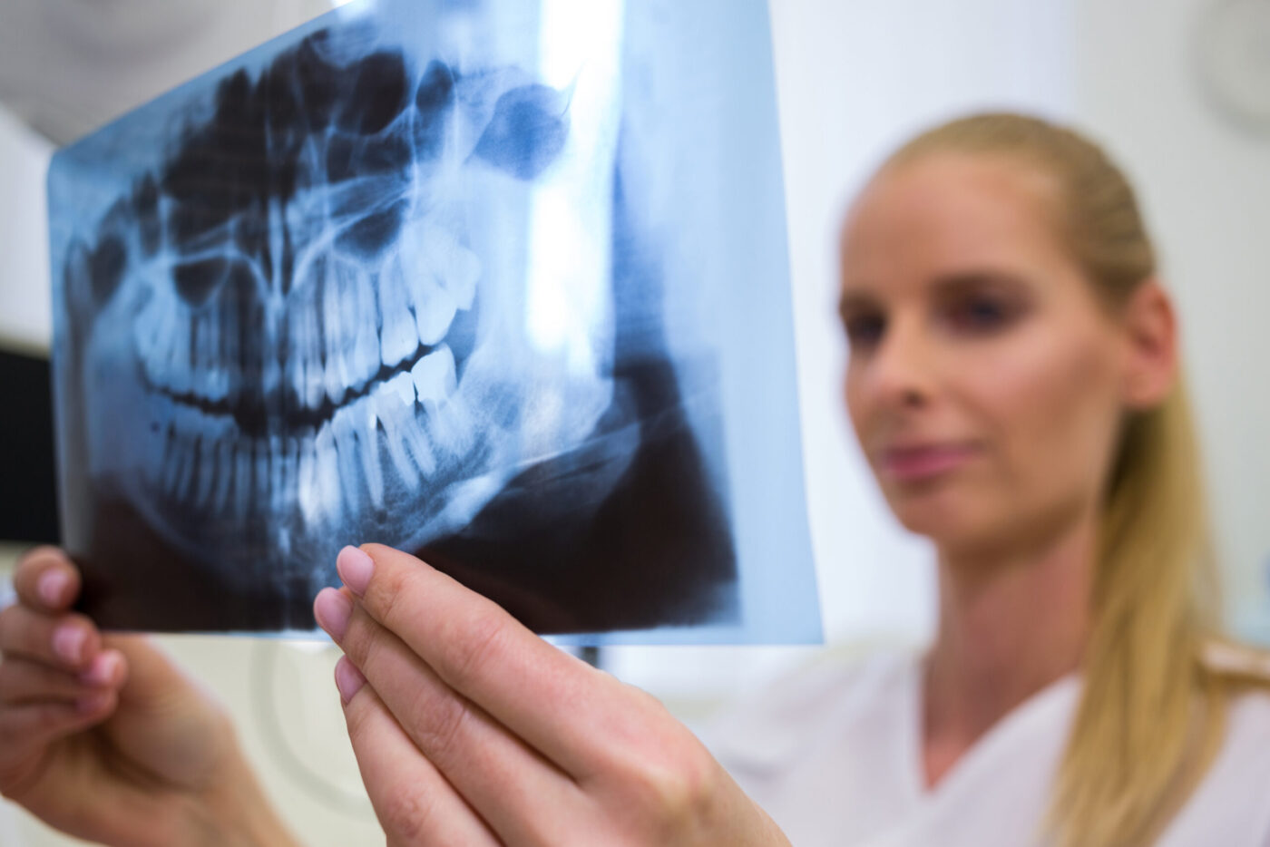 Radiografía dental panorámica sostenida por una profesional — formación para el empleo